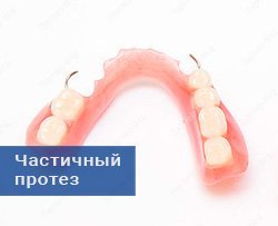 частичный съемный акриловый протез