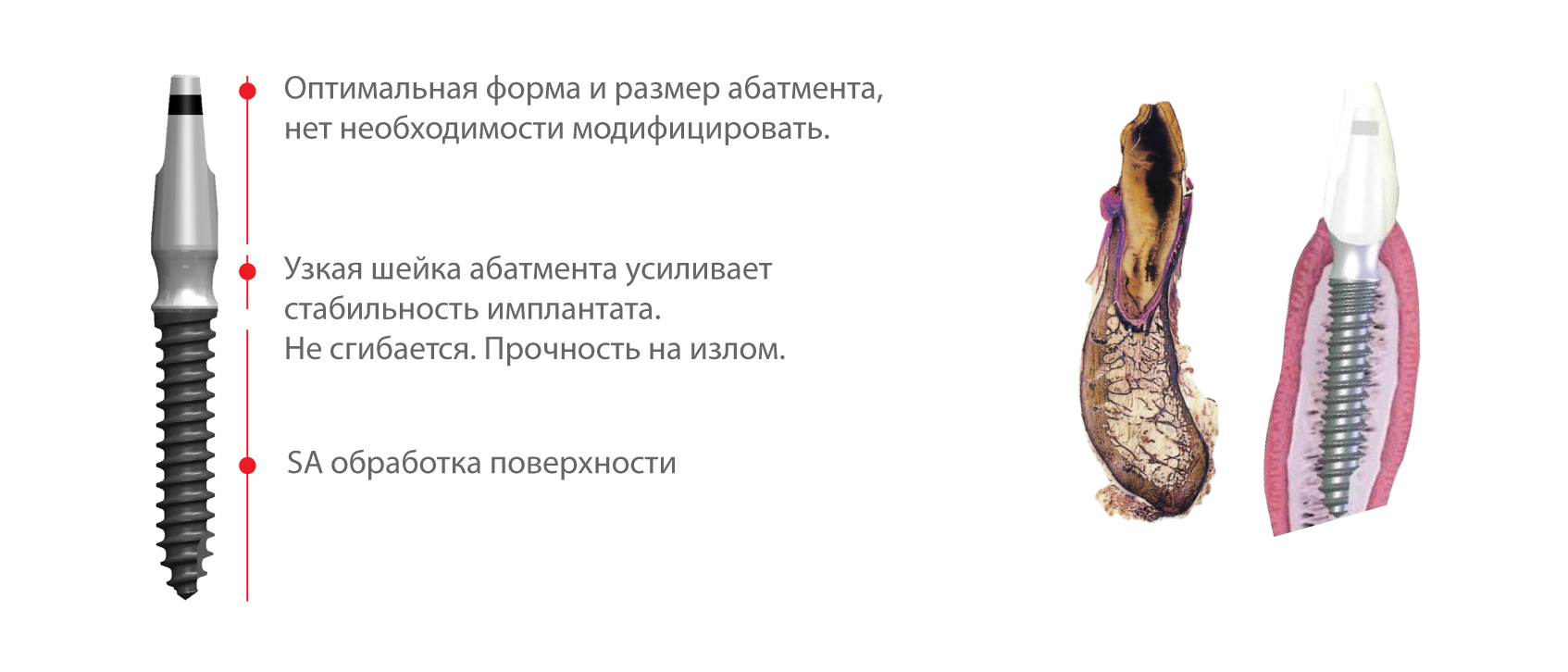 имплант мс