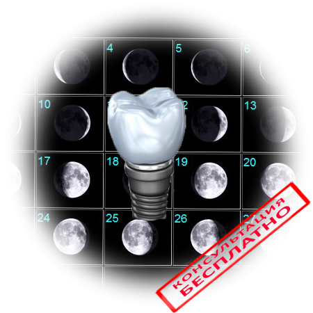 Лечение зубов и лунный календарь: благоприятные дни для лечения зубов