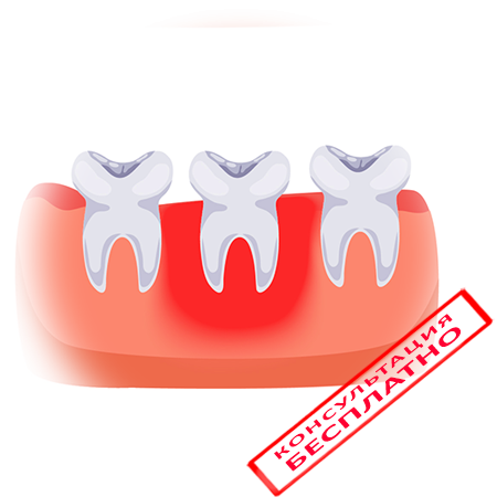 Почему десна отошла от зуба и что с этим делать | Лесной Бальзам