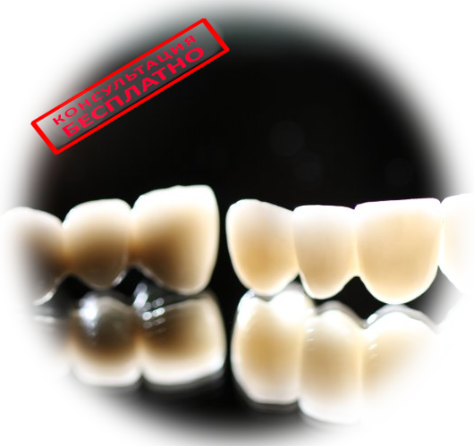 Коронки на зубы: какие лучше ставить