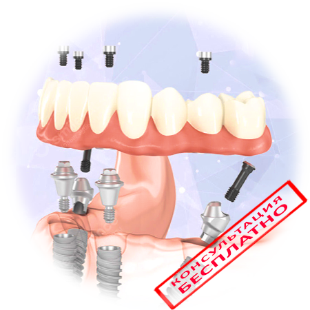Материалы протезов зубов: виды и особенности — ROOTT