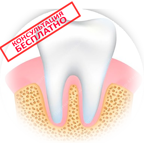 Потемнение зуба под пломбой – причины и лечение