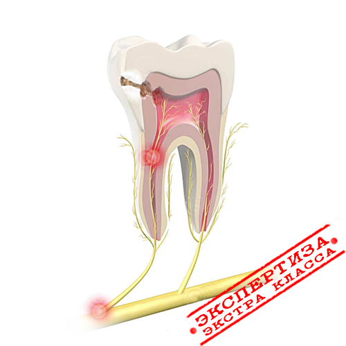Зубы во время беременности — уход, лечение