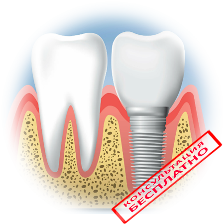 Все о боли после установки имплантов зубов — что болит, сколько дней длится боль, как ее уменьшить
