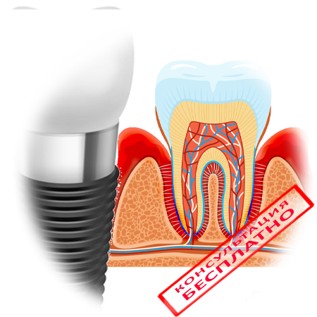 Что такое протрузия зубов?