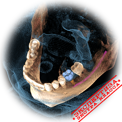 Компьютерная томография зубов и в каких случаях она нужна | Cтоматология Люксар