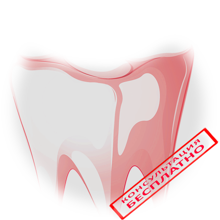 Сломался зуб под корень – что делать?