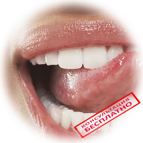 Глоссит или воспаление языка у взрослых: виды, симптомы, лечение