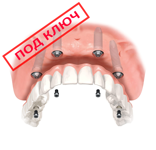 Консольные протезы зубов | вторсырье-м.рф