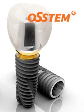 Имплант Osstem (Осстем) с диоксид-циркониевой коронкой 
