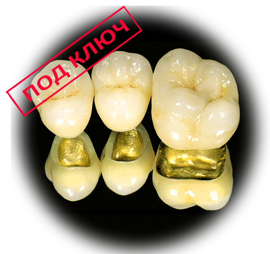 Скол керамического зуба - как можно укрепить?
