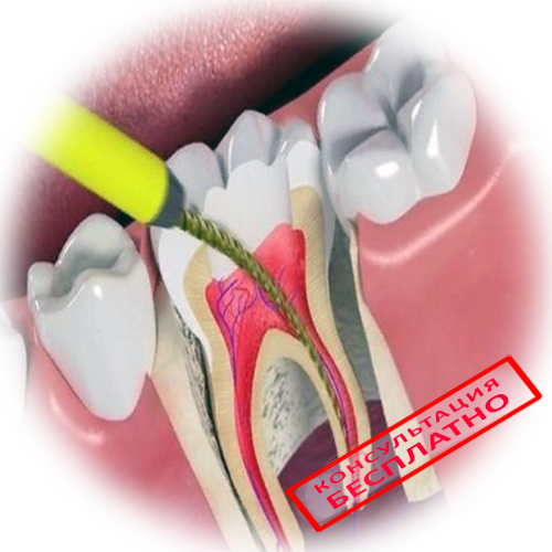 Как отличить зубную боль от воспаления тройничного нерва