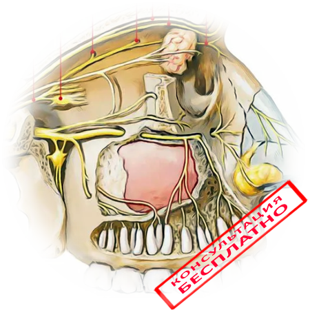 Воспаление тройничного нерва