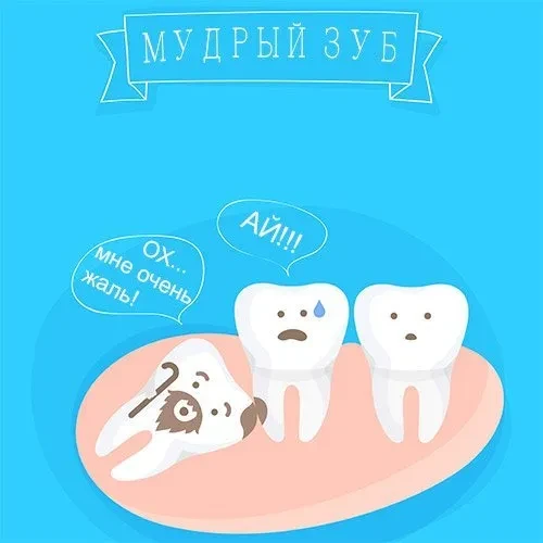Удаление зуба мудрости: показания и последствия