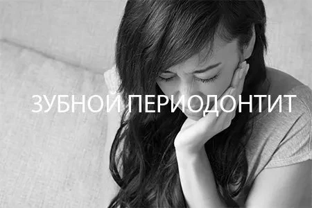 Хронический периодонтит зуба