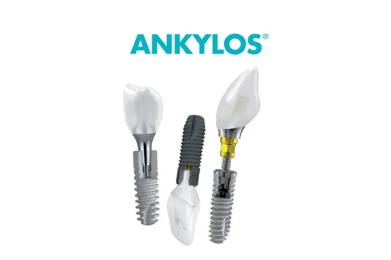 Немецкие импланты Ankylos Немецкие импланты Ankylos