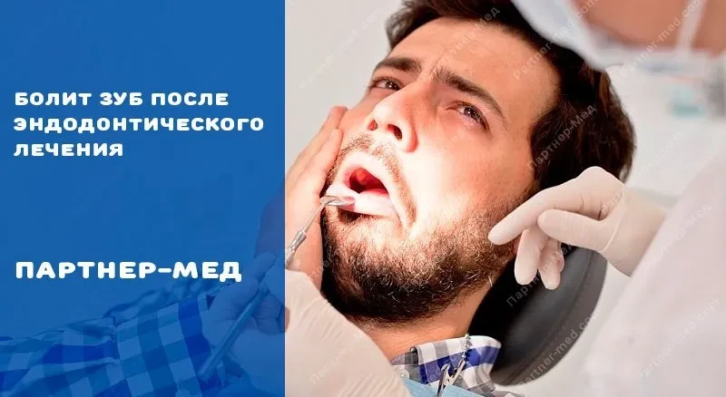 Боль после эндодонтического лечения зуба
