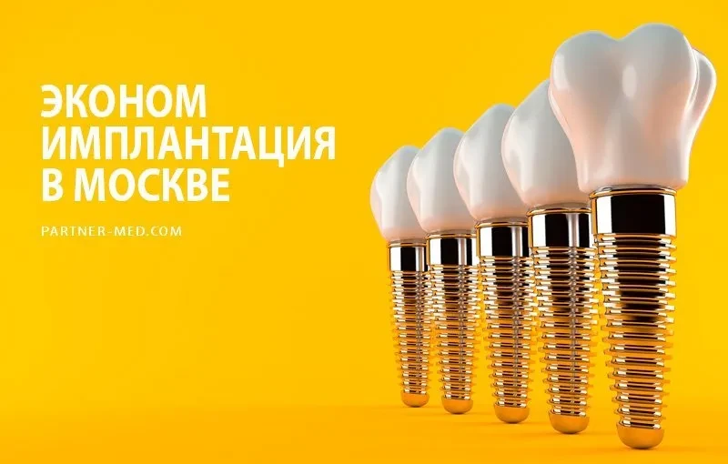Зубные импланты эконом-класса Зубные импланты эконом-класса