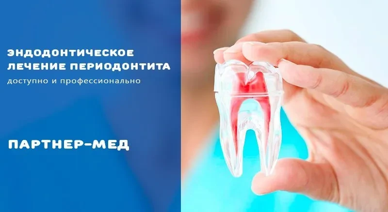 Эндодонтическое лечение периодонтита зубов
