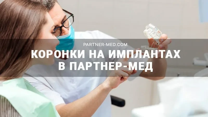 Какие зубные коронки лучше ставить на имплант?