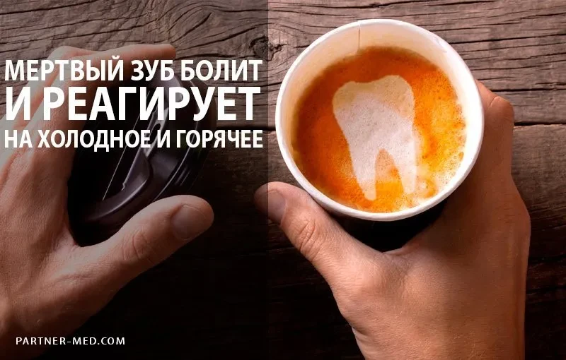 Мертвый зуб болит, реагирует на холодное и горячее