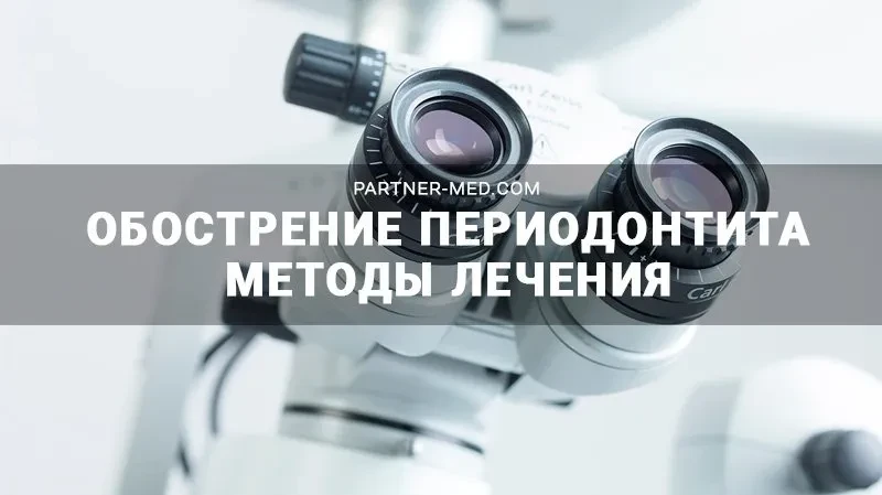 Обострение периодонтита