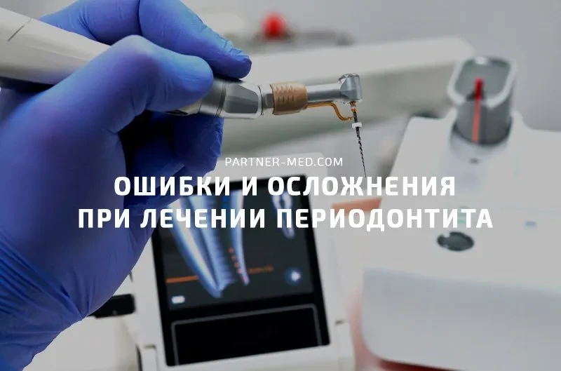Ошибки и осложнения при лечении периодонтита