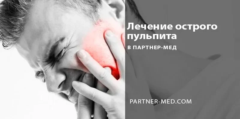 Острый пульпит зуба: диагностика и лечение