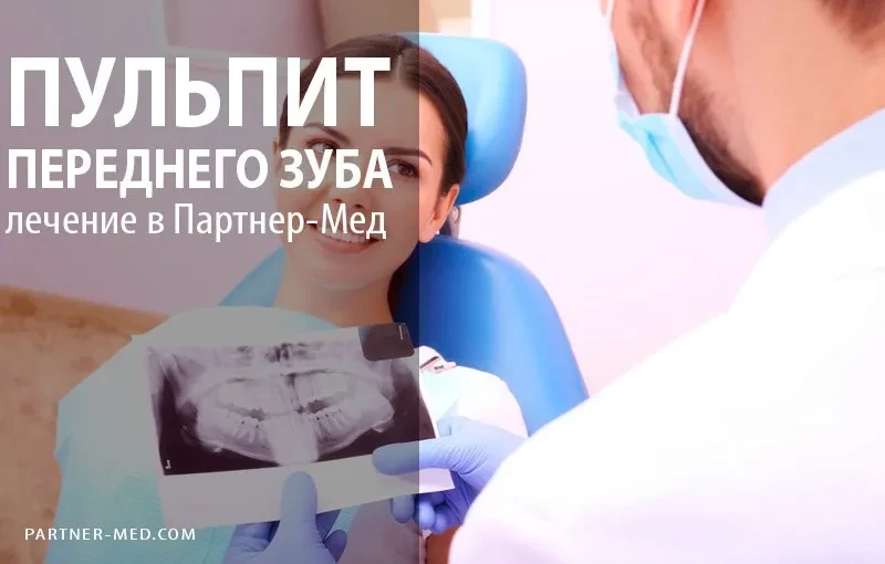 Лечение пульпита переднего зуба