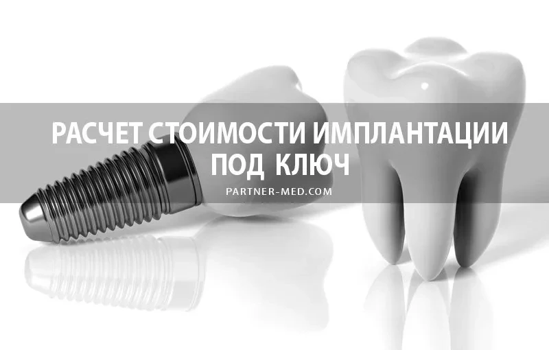 Рассчитать стоимость имплантации зубов Рассчитать стоимость имплантации зубов