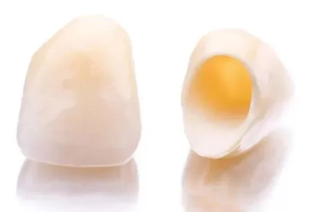 Коронки из диоксида циркония