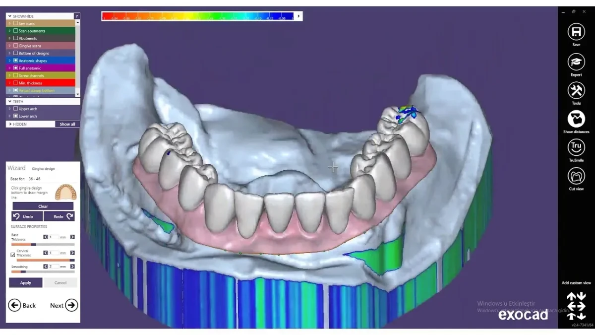 Особенности метода CAD/CAM в изготовлении коронок из циркония