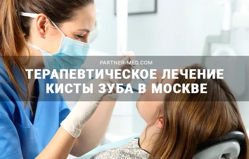 Терапевтическое лечение кисты зуба