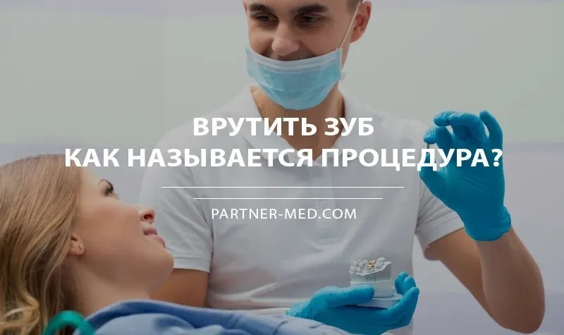 Вкрутить зуб в десну Вкрутить зуб в десну