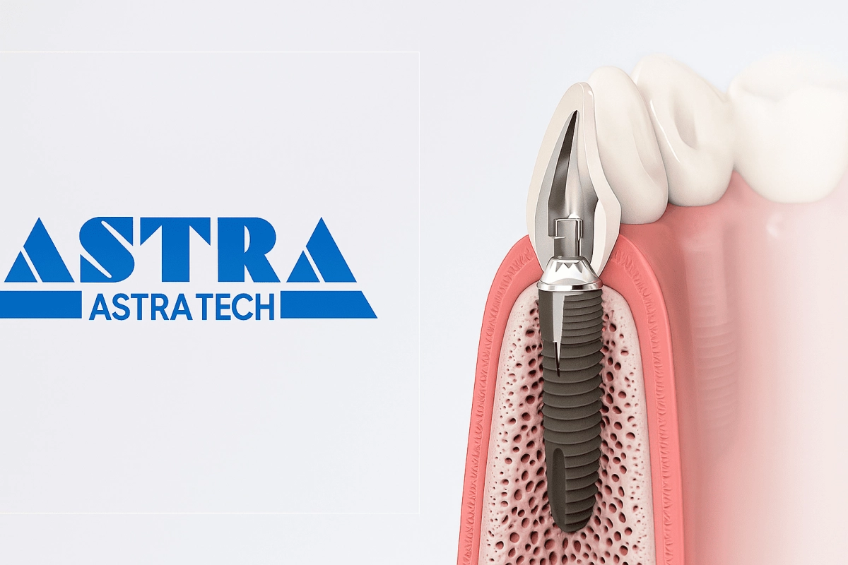 Имплант (Астра-Тек) Astra Tech имплантация и протезирование